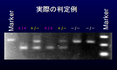 遺伝子型判定例